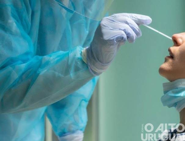 Estoque de testes para Covid-19 está reduzido em FW