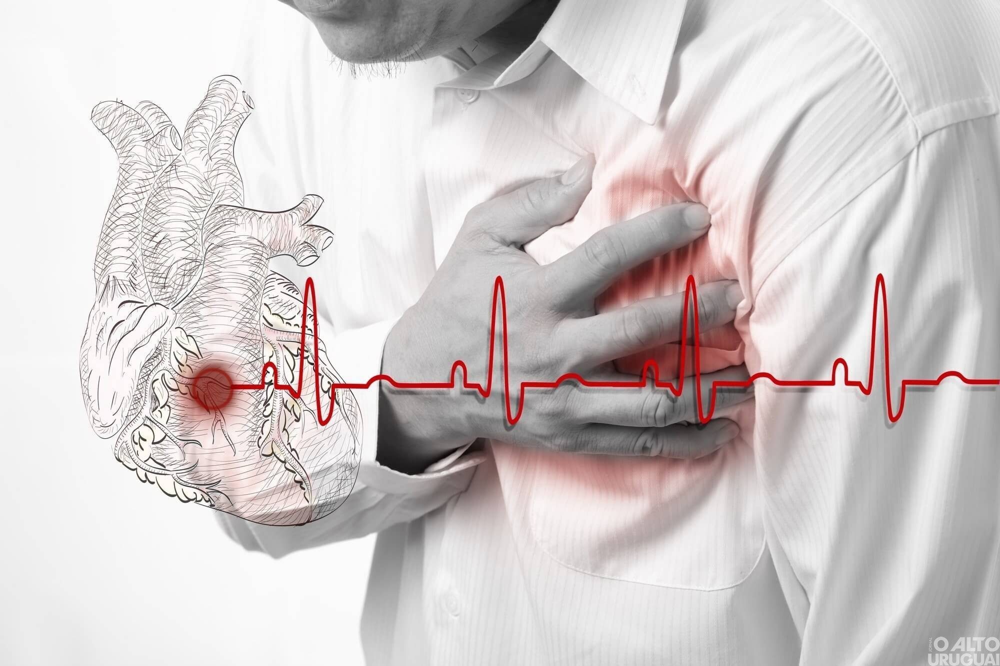 Incidência de infarto no inverno pode aumentar em 30%