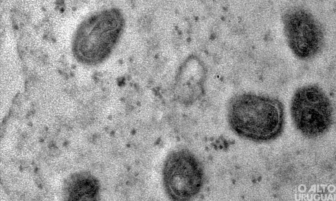 OMS declara fim da emergência em saúde por mpox